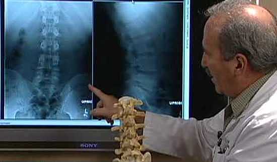 врач-демонстрирует-рентгенограмму